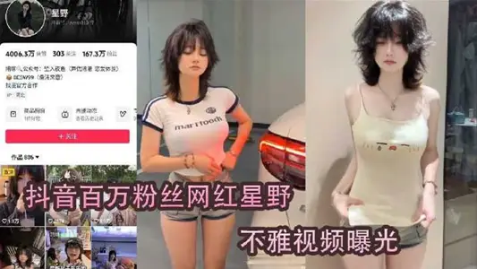 Shake the sound net red [xingye] is suspected to be under the first line of the fat pig list!