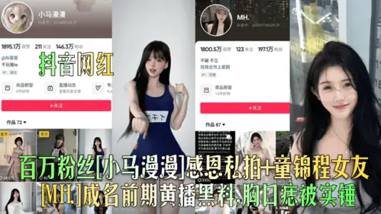 Shake the sound net red millions of fans pony long gratitude private pat tong jincheng girlfriend MH fame early yellow black material chest mole was hammered
